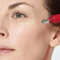 Immagine 3 - L'Oréal Paris Revitalift Laser Trattamento Occhi Anti-Borse Anti-Rughe Idratante Levigante Effetto Lifting - Flacone da 15ml